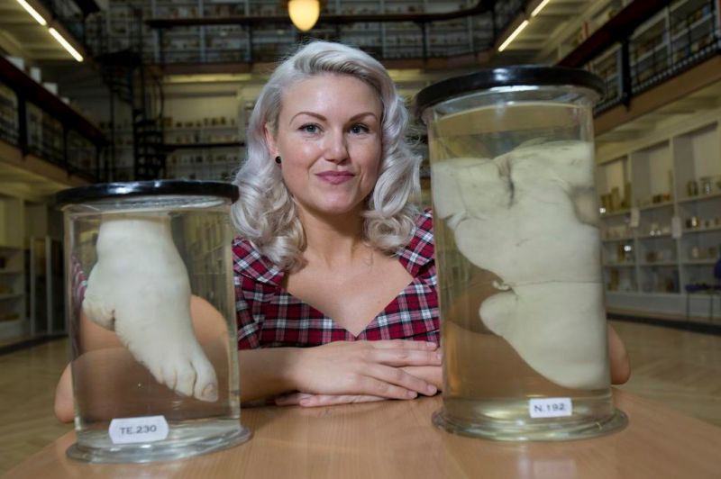 Just two of the great specimens: "Tight Lacer's Liver" and Chinese "Bound Foot"