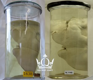 N.192 Before and After