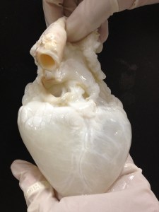 Image: Courtesy of RMR Labs, Texas Heart Institute