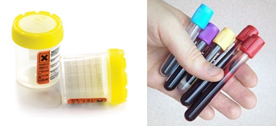 Histology pots and typical blood tubes